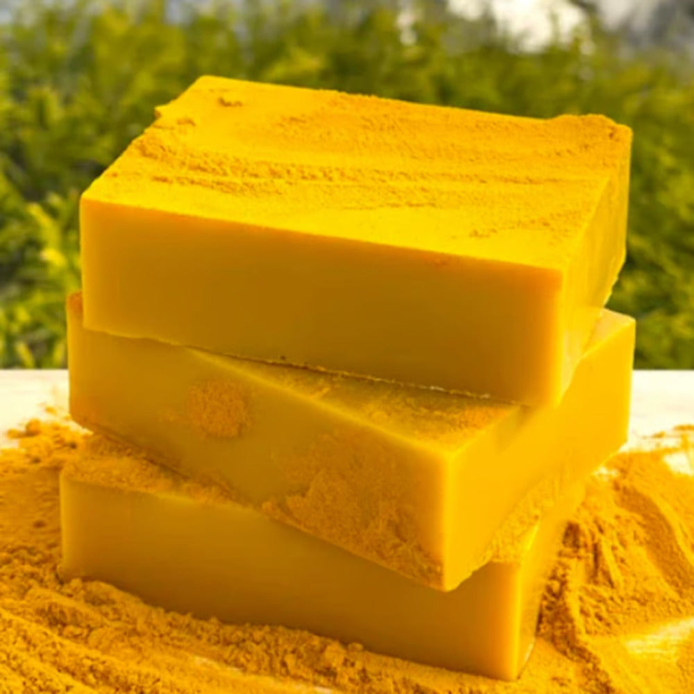 Turmeric & Kojic Acid Dark Spot Remover Soap Bars (Pack of 2)