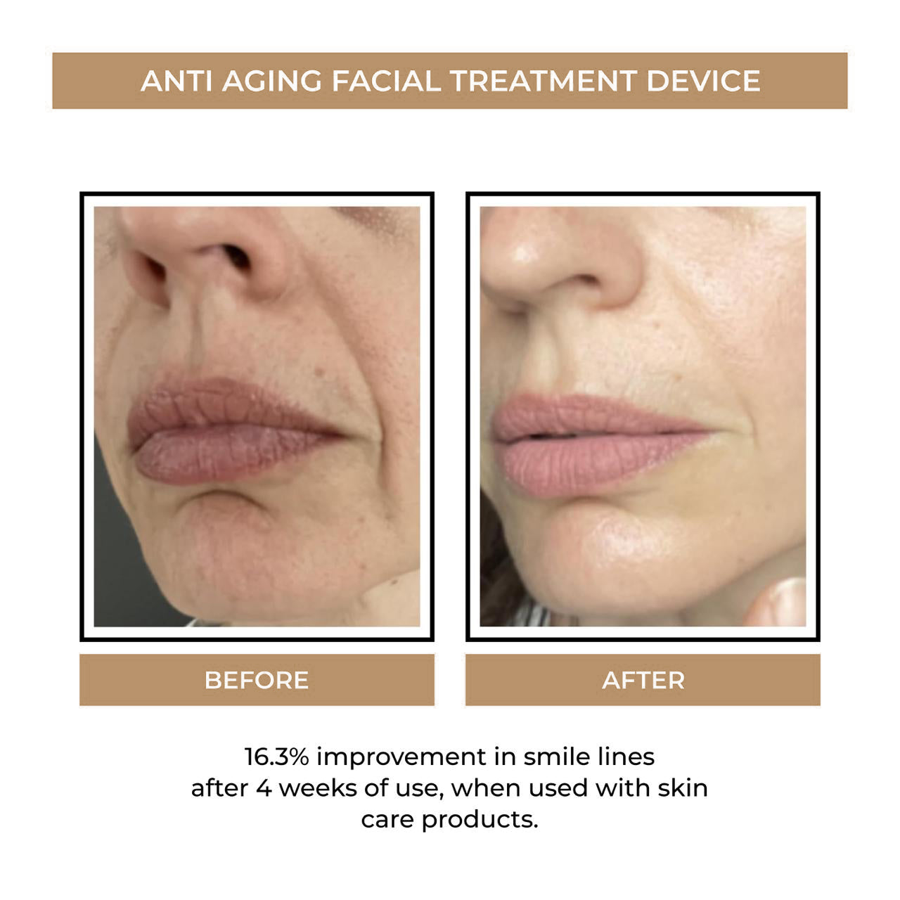 Anti Ageing Facial Treatment Device