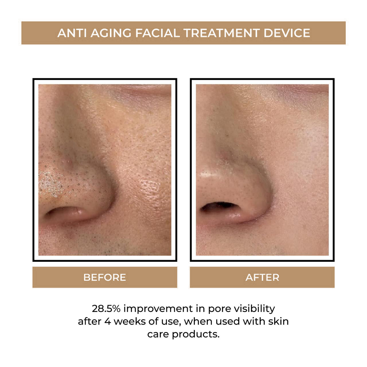 Anti Ageing Facial Treatment Device