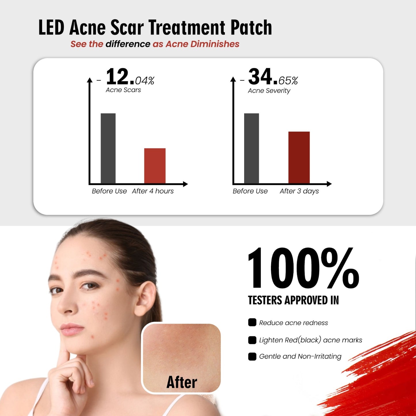 WBC Acne bye LED Therapy Patch