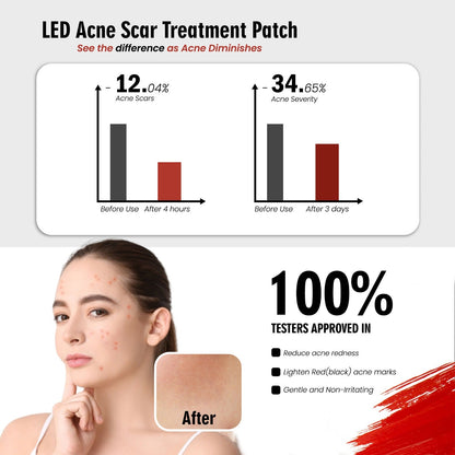 WBC Acne bye LED Therapy Patch